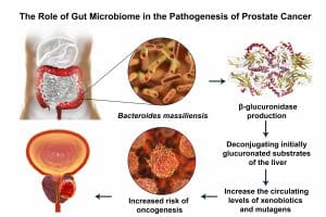 Gut microbiome and prostate cancer